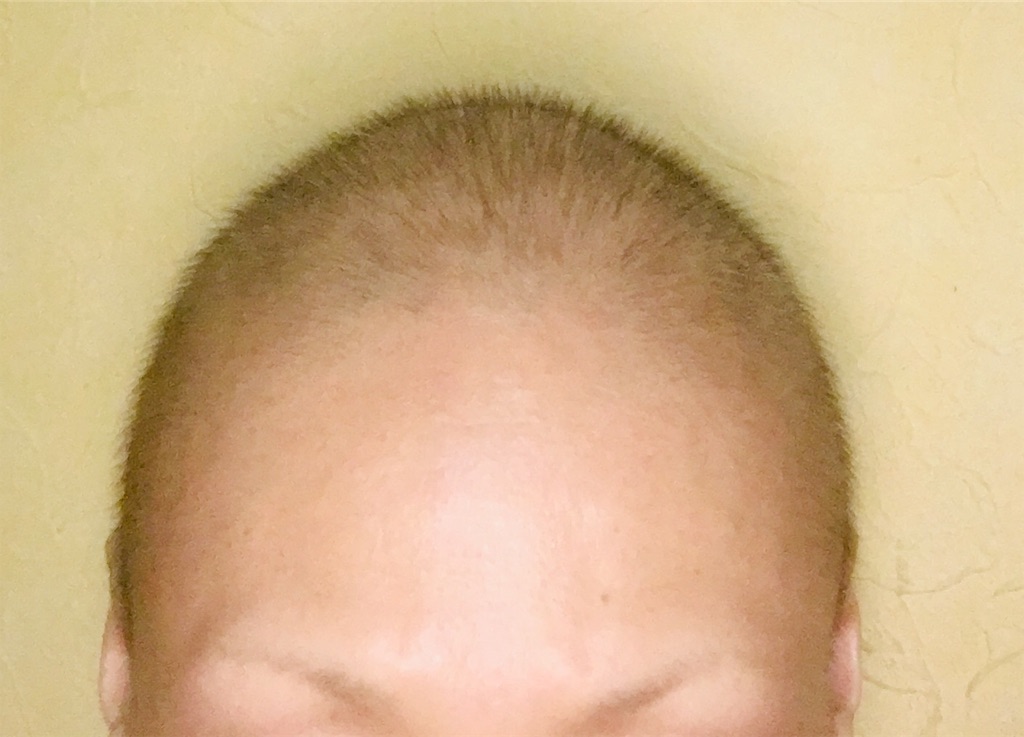 f:id:tomokoblog:20190710205246j:image