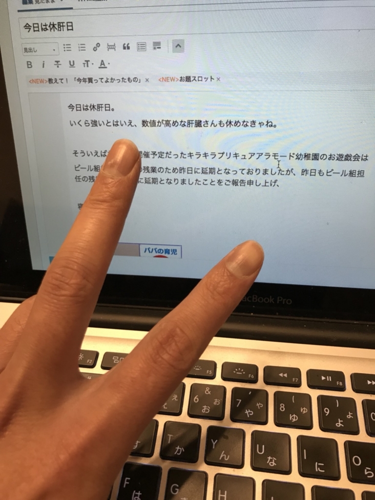 f:id:tomoosewaninarimasu:20171213005123j:plain f:id:tomoosewaninarimasu:20171213005123j:plain