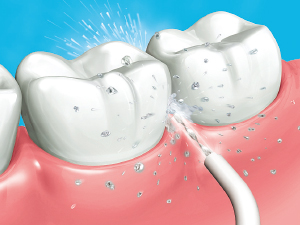 ジェットウォッシャードルツ EW-DJ61-W