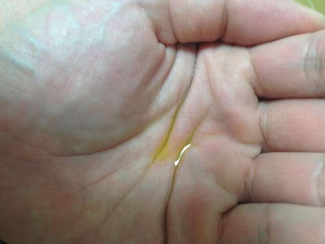 ホホバオイルの効果