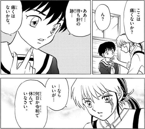 「MAO」(高橋留美子)86話より、菜花の喉に針の跡が