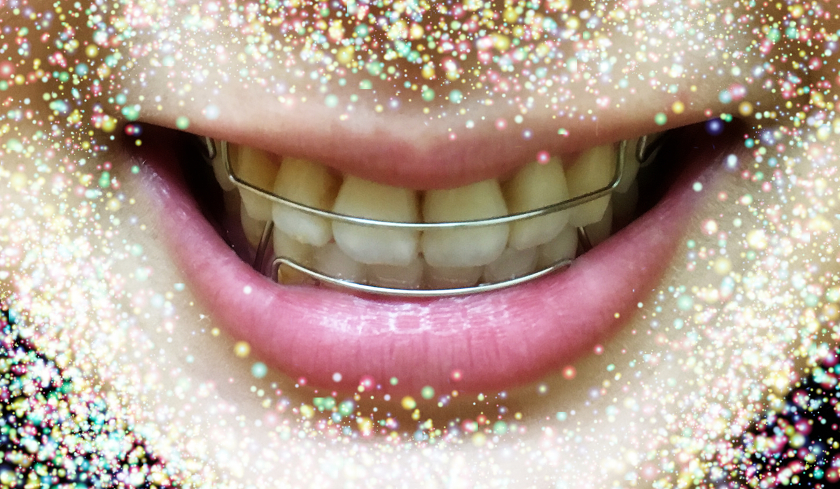 f:id:toothdiary:20200215224448j:plain f:id:toothdiary:20200215224448j:plain
