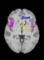 Cravings for High-Calorie Foods May Be Switched Off in the Brain byNew Supplement