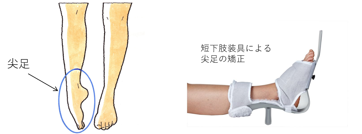 f:id:toratezza0316:20210124091143p:plain