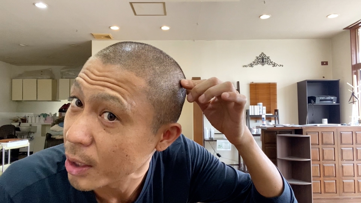 頭頂部薄毛がオシャレ坊主に！3mm坊主が重要です！