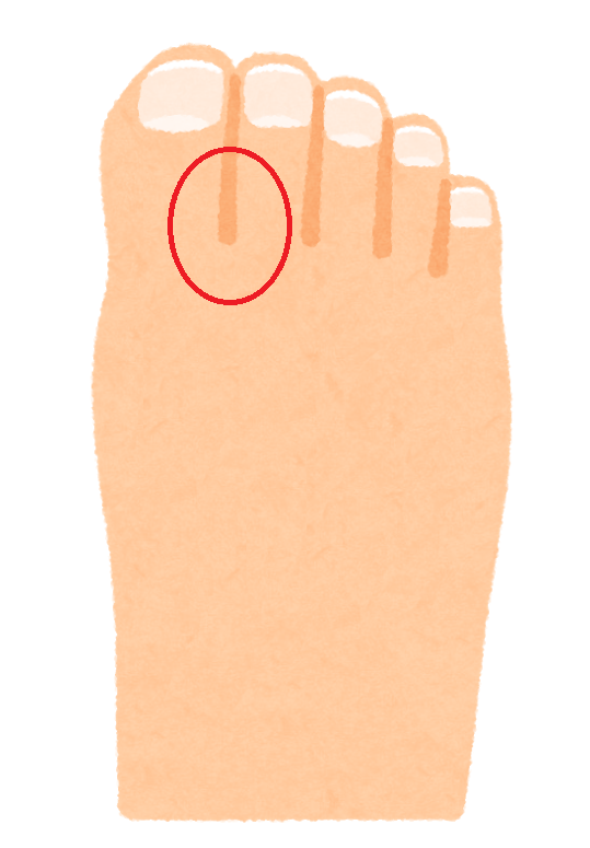 f:id:tottokotokoroten:20171008164942p:image:w120