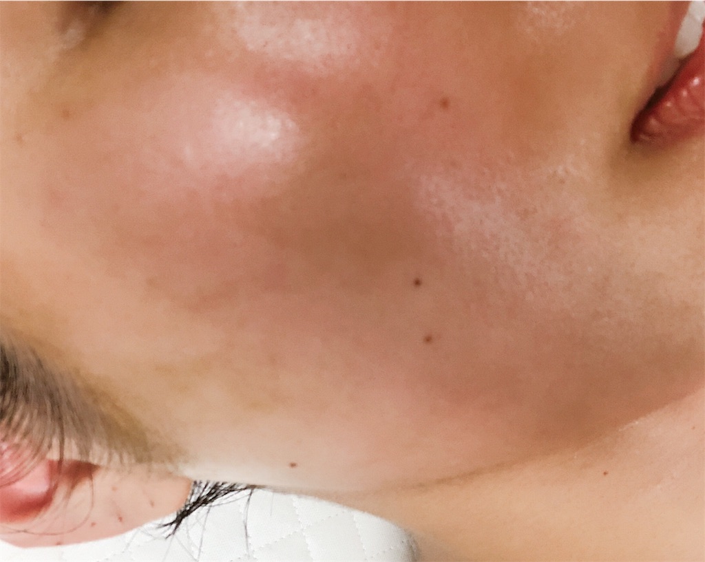 f:id:toxic-chia:20190211165004j:image f:id:toxic-chia:20190211165004j:image