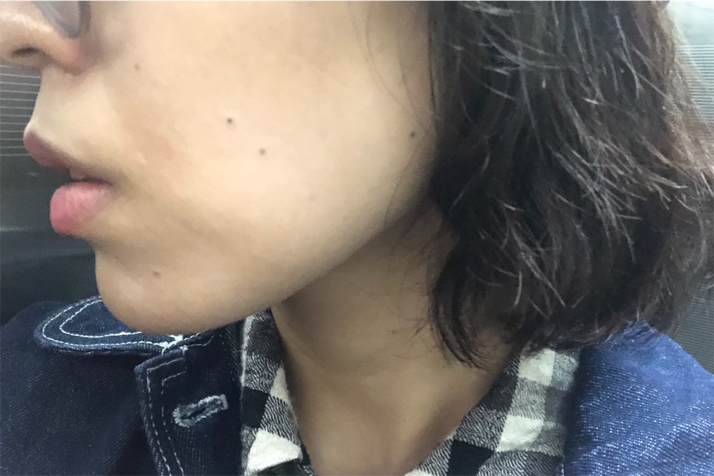 f:id:toxic-chia:20190516133610j:image