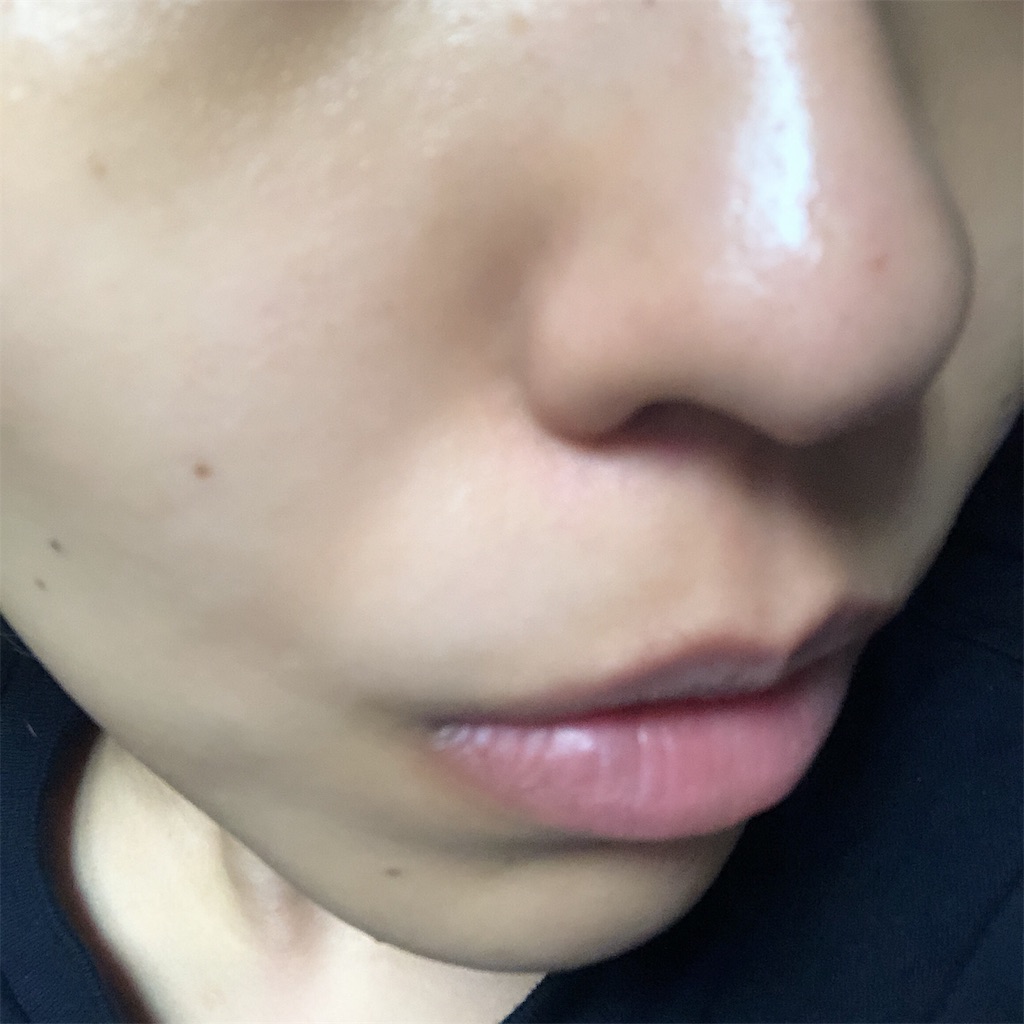 f:id:toxic-chia:20190516133614j:image