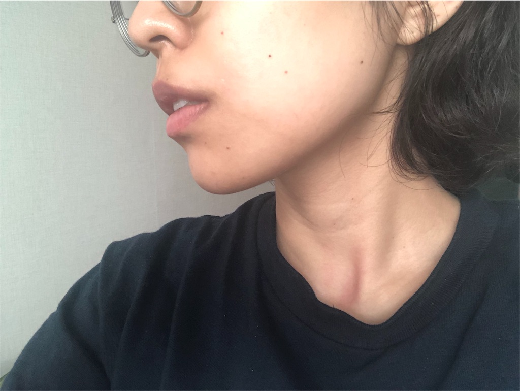 f:id:toxic-chia:20190516133618j:image