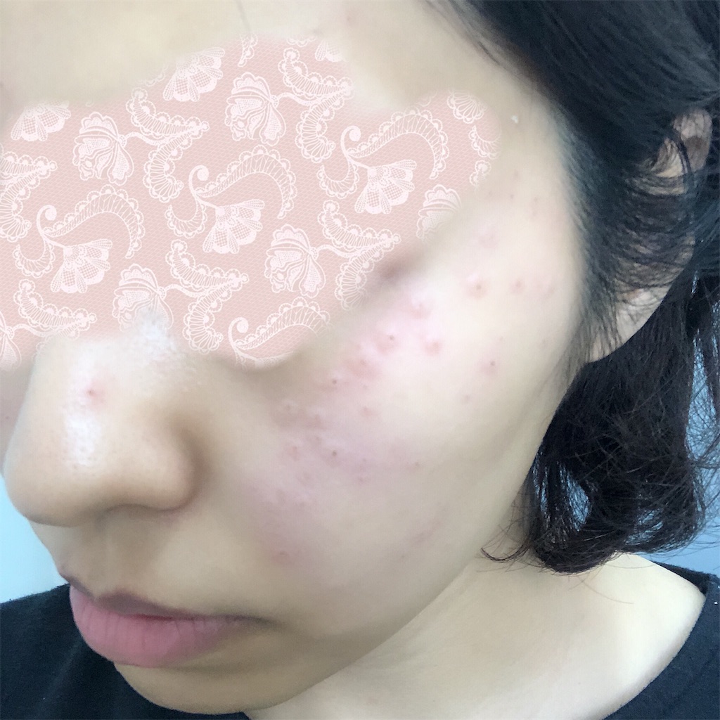 f:id:toxic-chia:20190529174303j:image