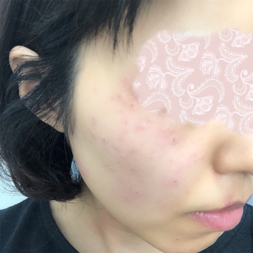 f:id:toxic-chia:20190529174306j:image