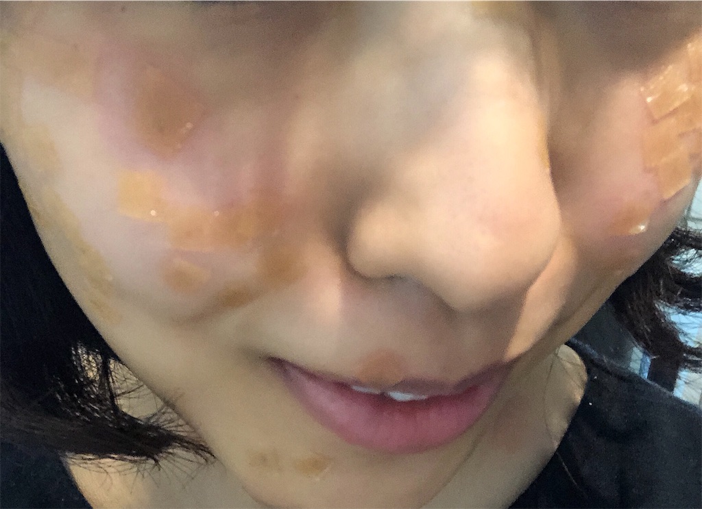 f:id:toxic-chia:20190529174316j:image