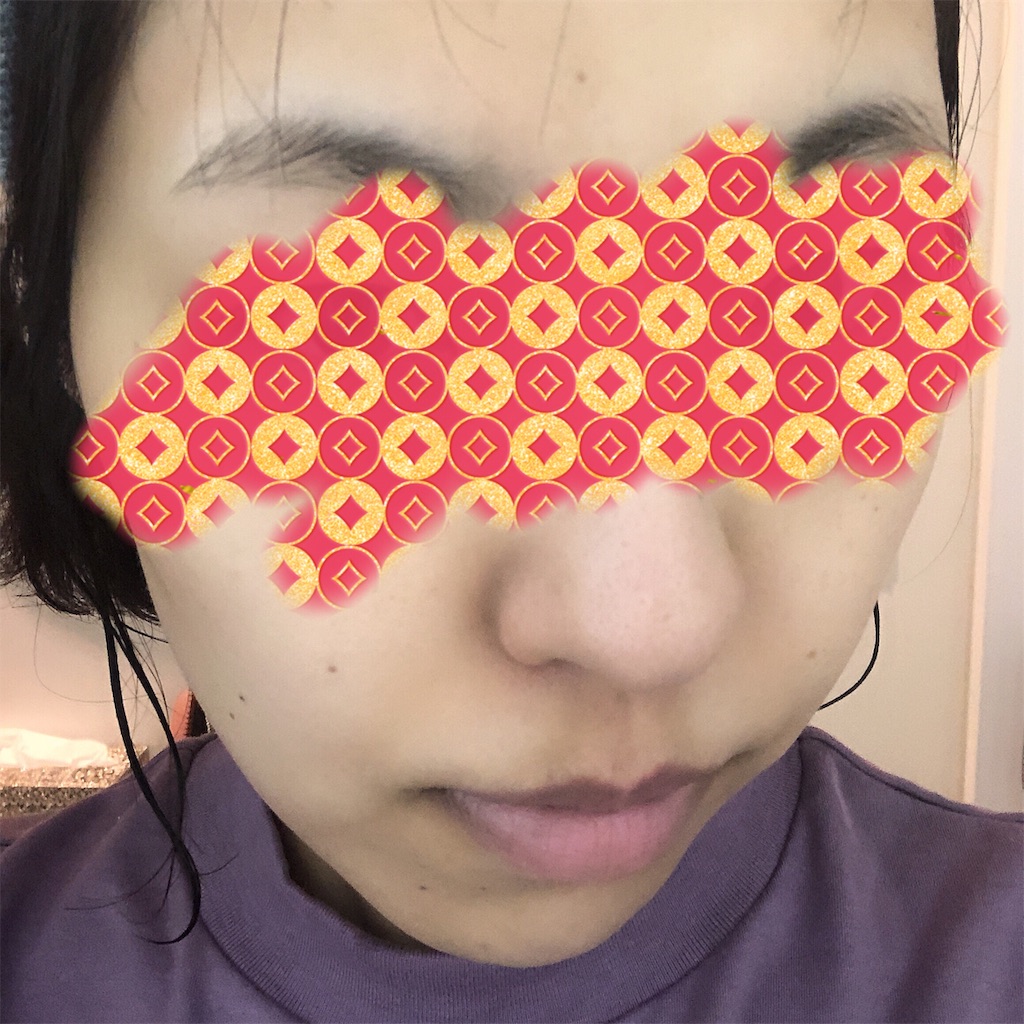 f:id:toxic-chia:20190530102137j:image f:id:toxic-chia:20190530102137j:image