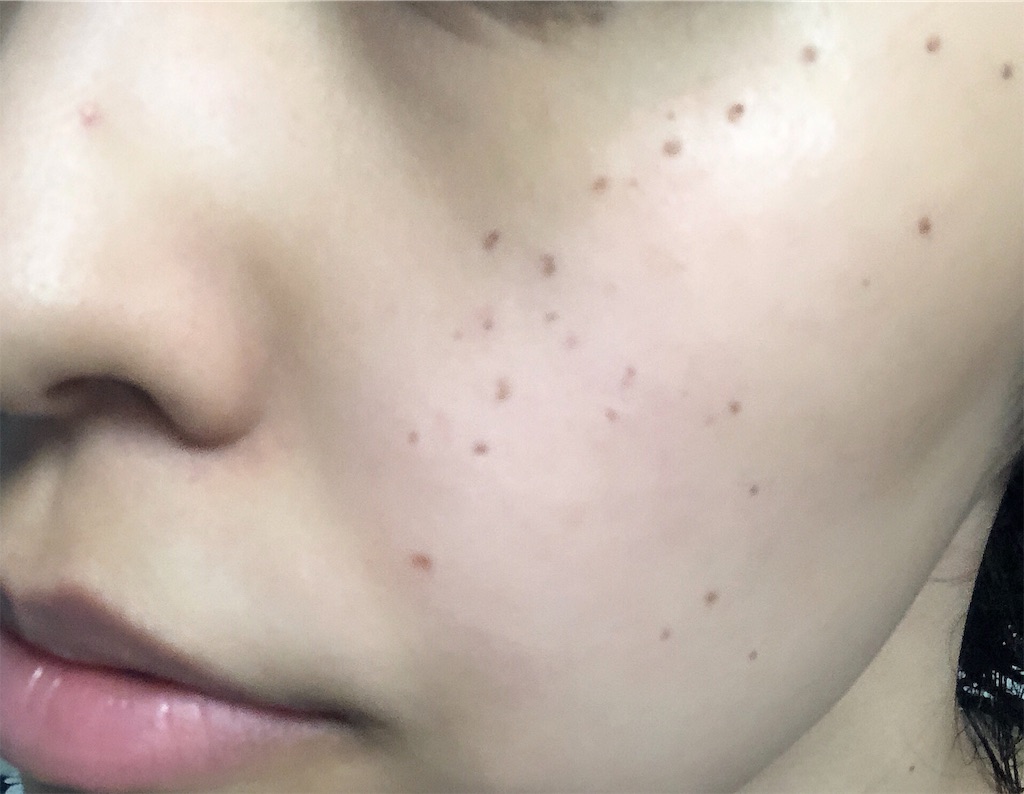 f:id:toxic-chia:20190604123435j:image