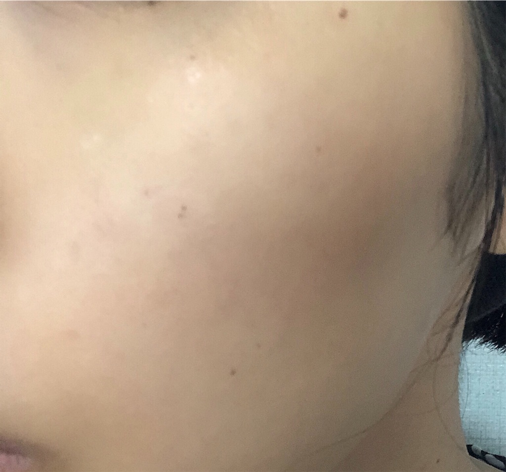 f:id:toxic-chia:20190616233536j:image