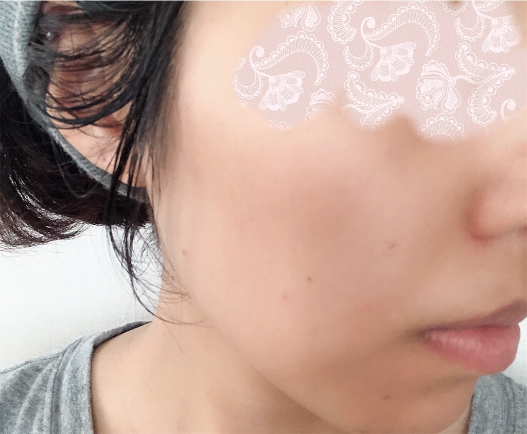 f:id:toxic-chia:20190616233544j:image