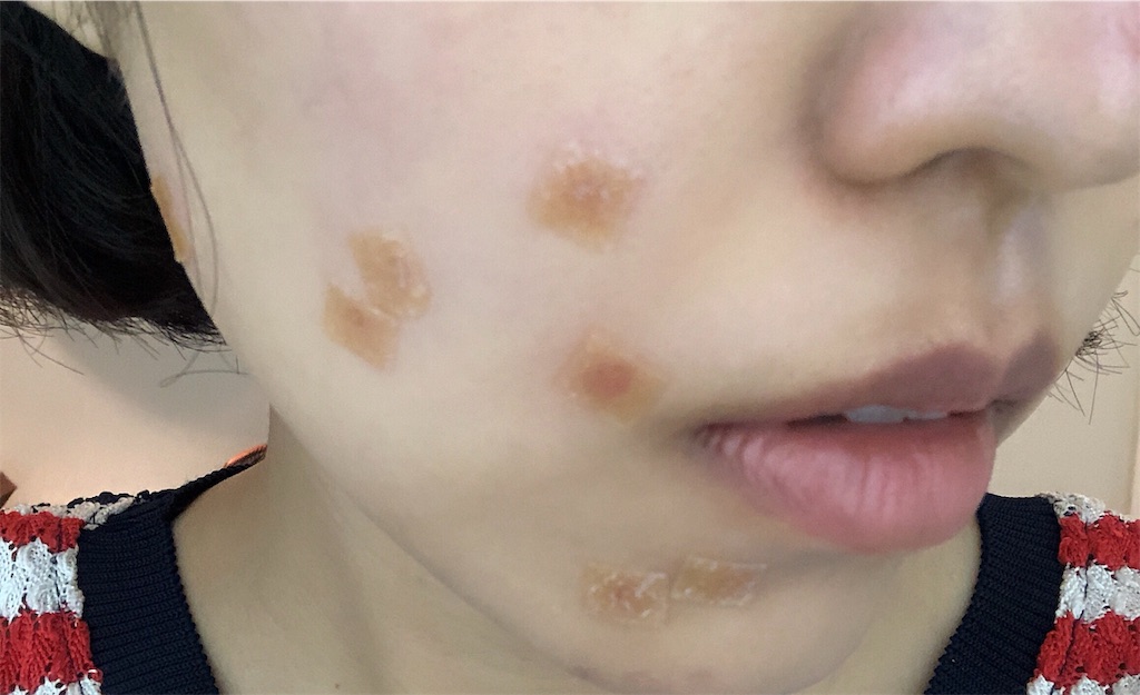 f:id:toxic-chia:20190619120709j:image