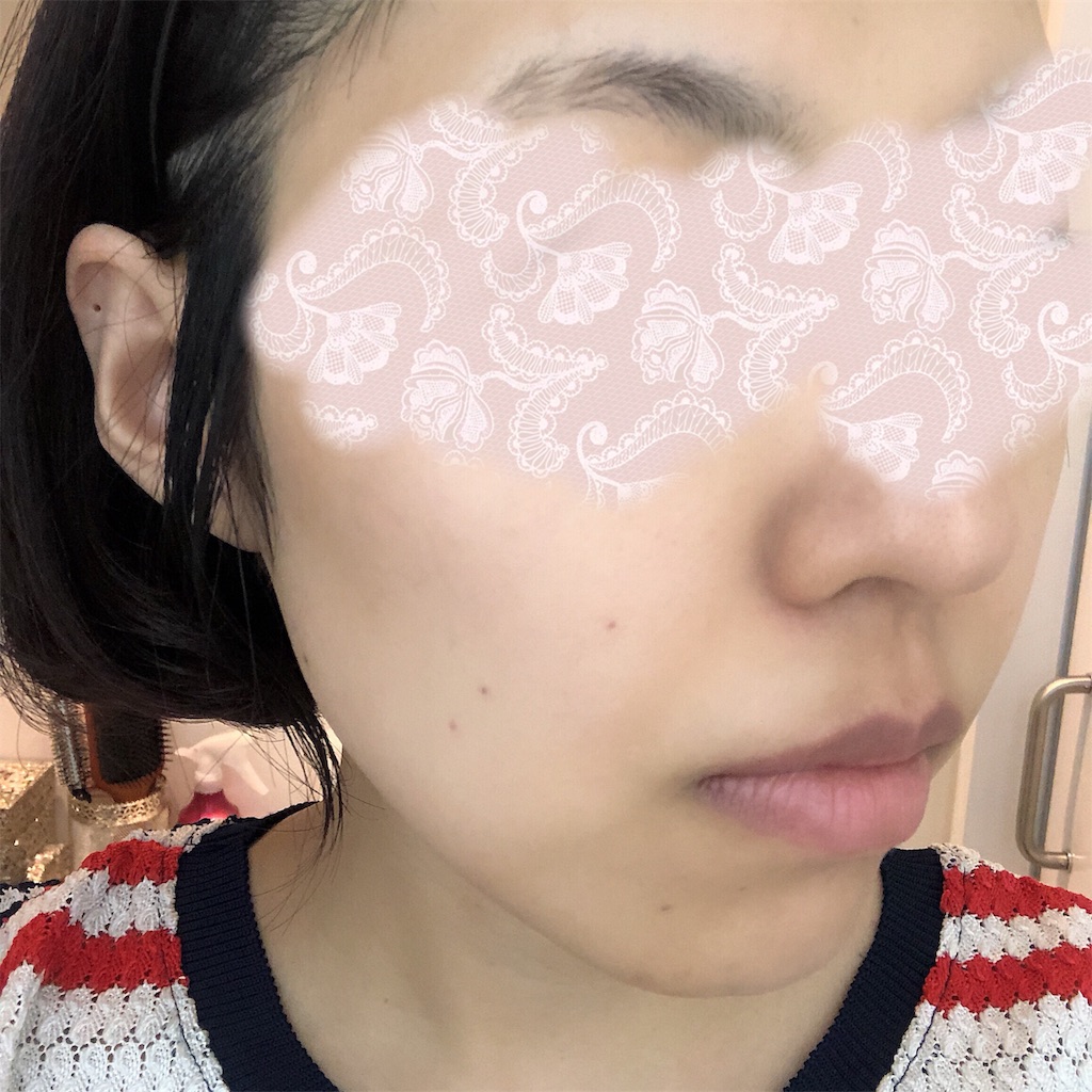 f:id:toxic-chia:20190619120712j:image