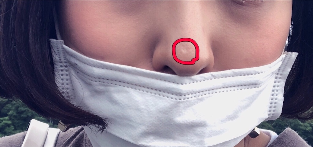 f:id:toxic-chia:20190622173644j:plain