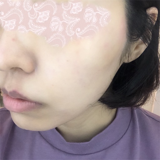 f:id:toxic-chia:20190715160102j:image