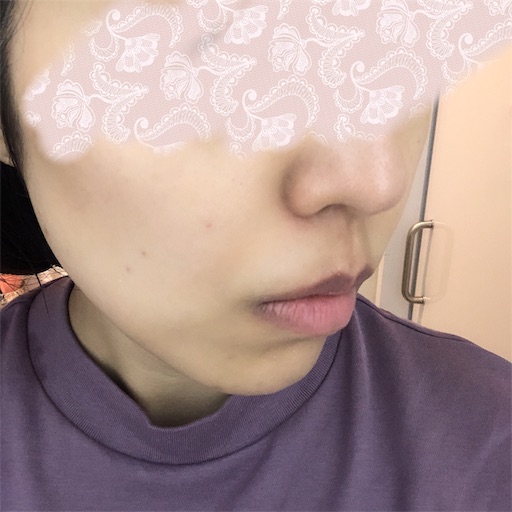 f:id:toxic-chia:20190715160104j:image