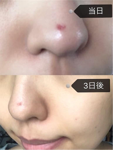 f:id:toxic-chia:20190715160109j:image
