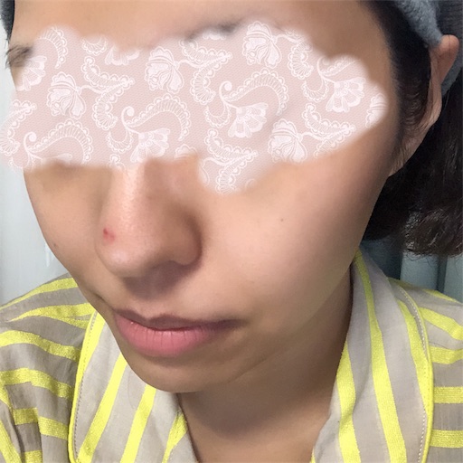 f:id:toxic-chia:20190727232331j:image f:id:toxic-chia:20190727232331j:image
