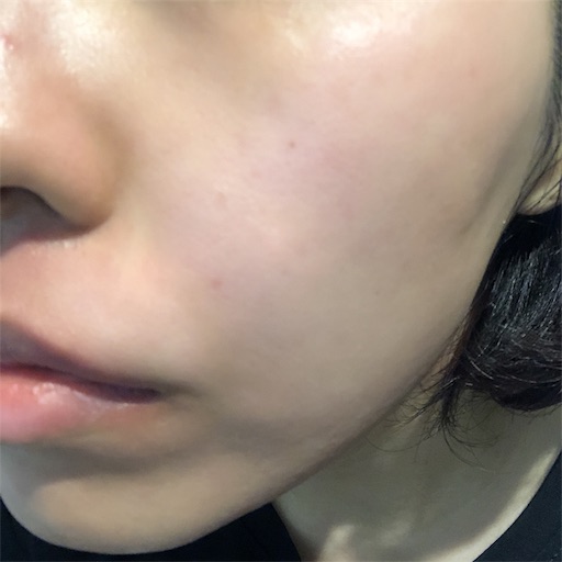 f:id:toxic-chia:20190729105402j:image f:id:toxic-chia:20190729105402j:image
