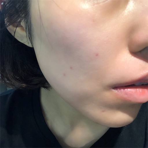 f:id:toxic-chia:20190729105448j:image f:id:toxic-chia:20190729105448j:image