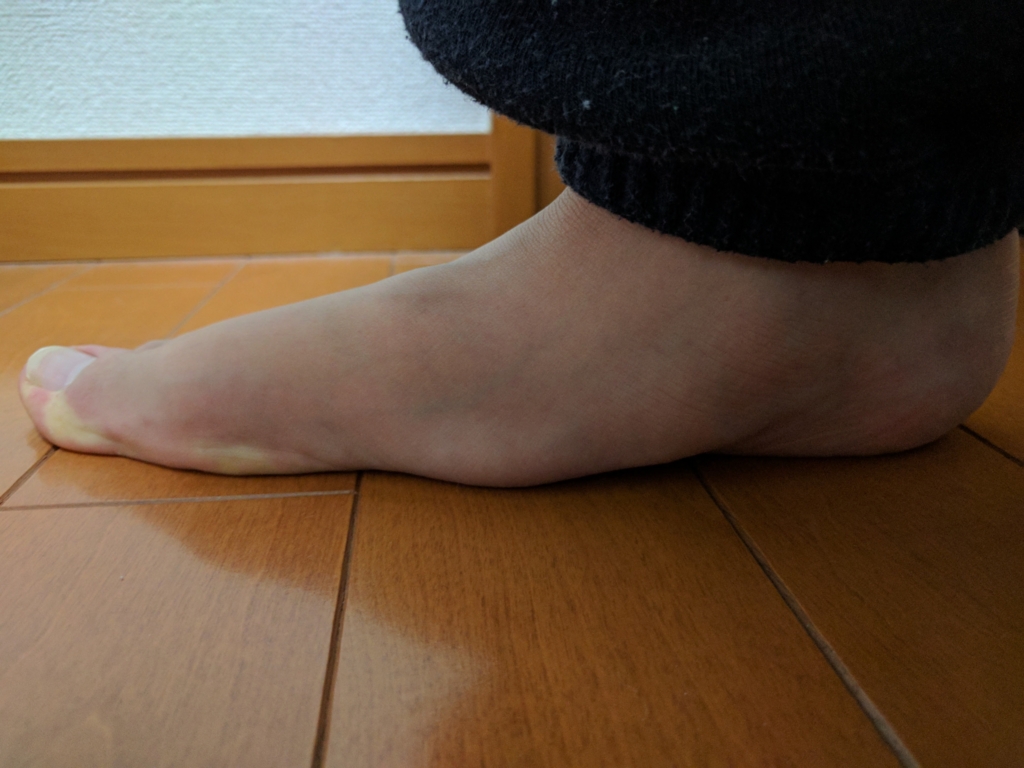 Treeのようにたくさんの枝を