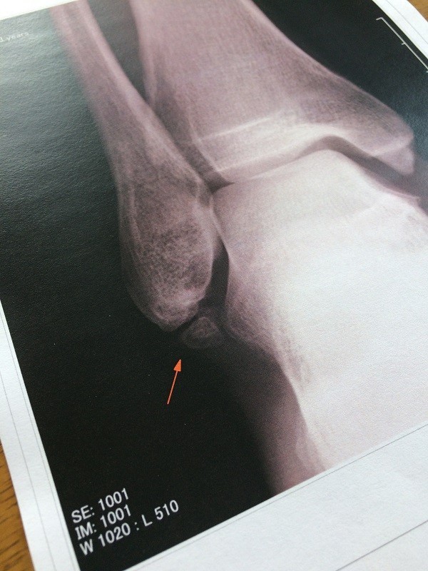 f:id:trekkie:20170708142553j:image f:id:trekkie:20170708142553j:image