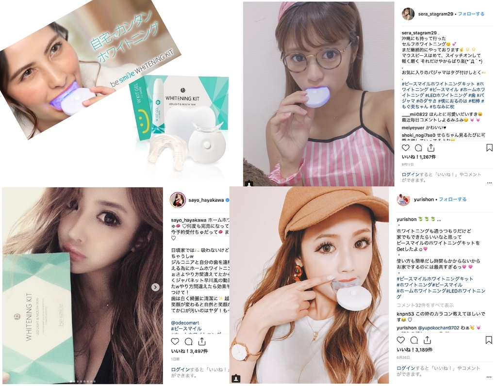 もう迷わない 自宅でできるホームホワイトニング6選 Trends Labo