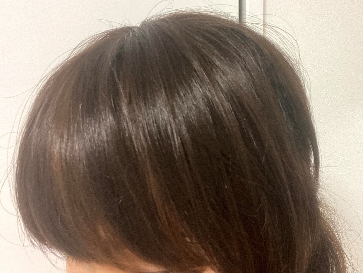 f:id:trichofighter:20210807212642j:plain