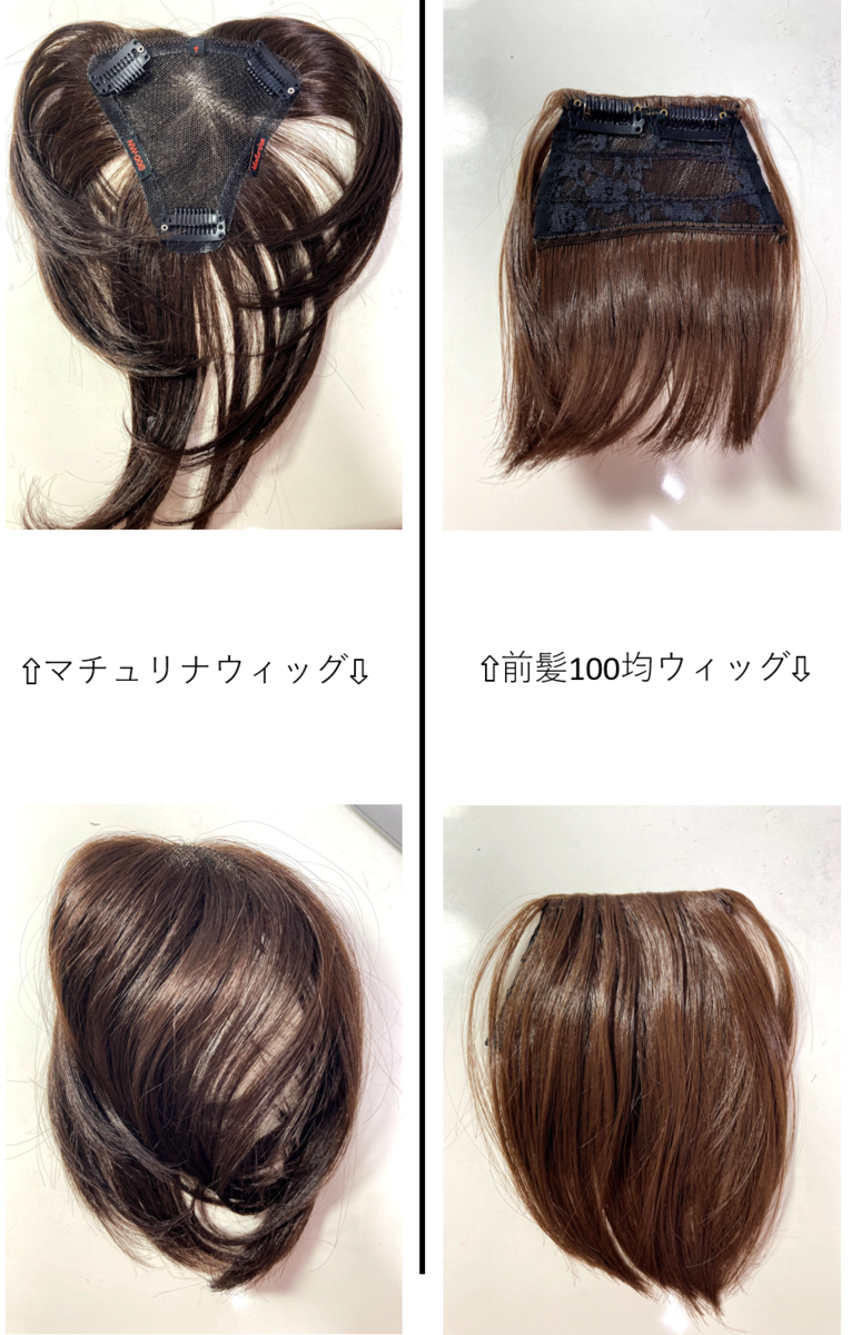 f:id:trichofighter:20210807213710p:plain