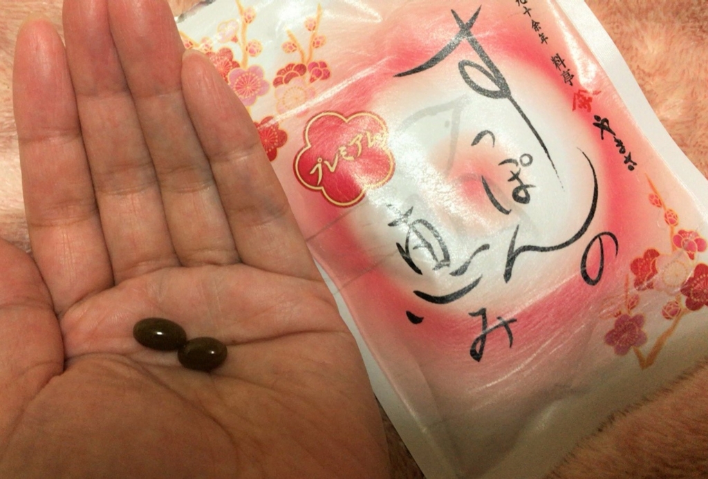 f:id:tsukunyan:20170120160604j:plain