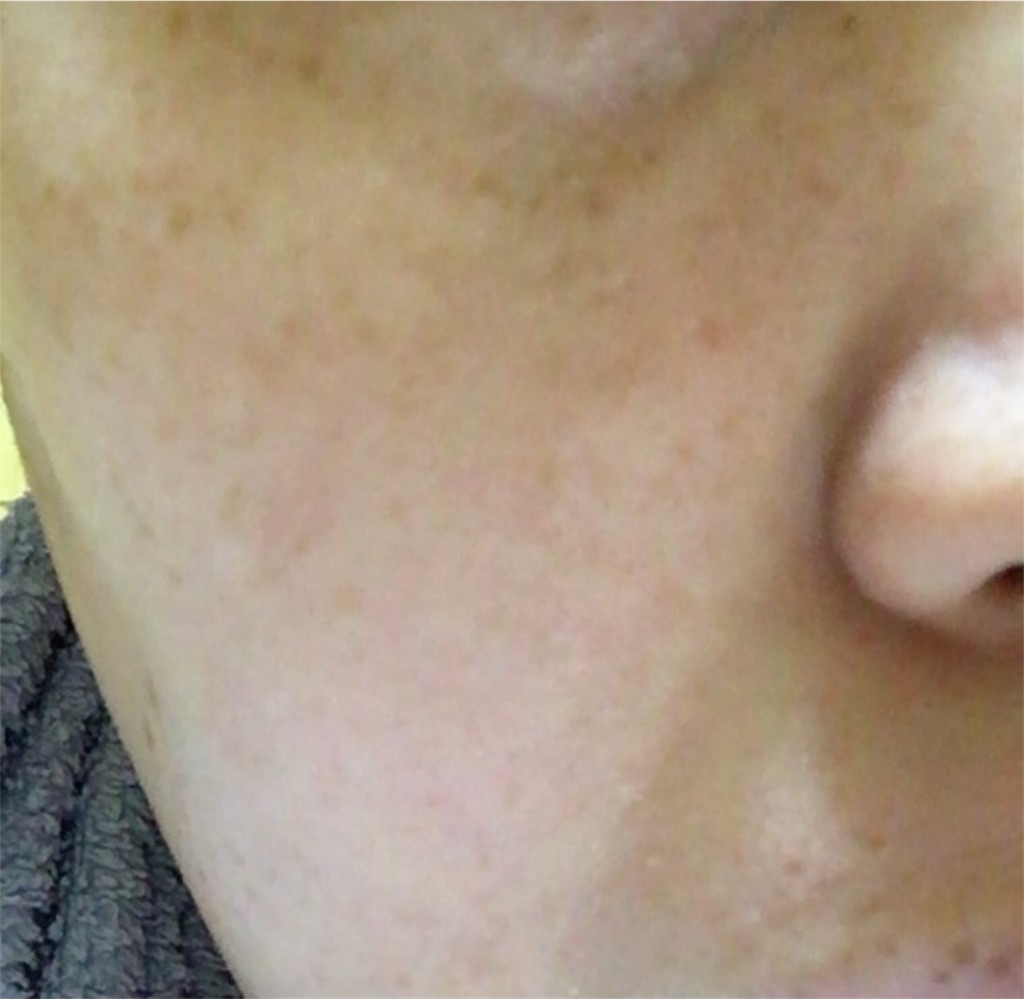 f:id:tsukunyan:20170220082830j:image f:id:tsukunyan:20170220082830j:image