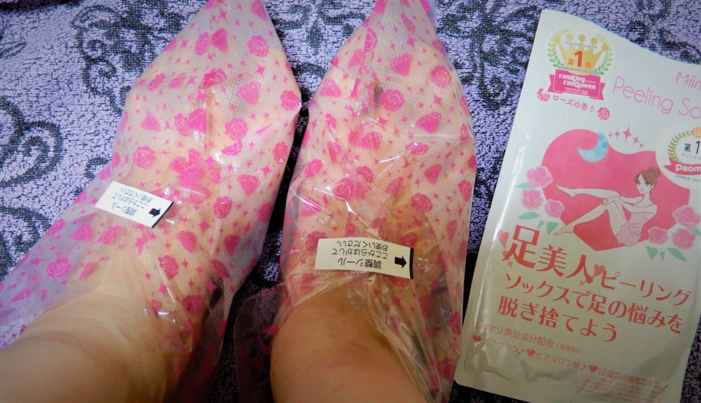 f:id:tsukunyan:20170508120900j:plain