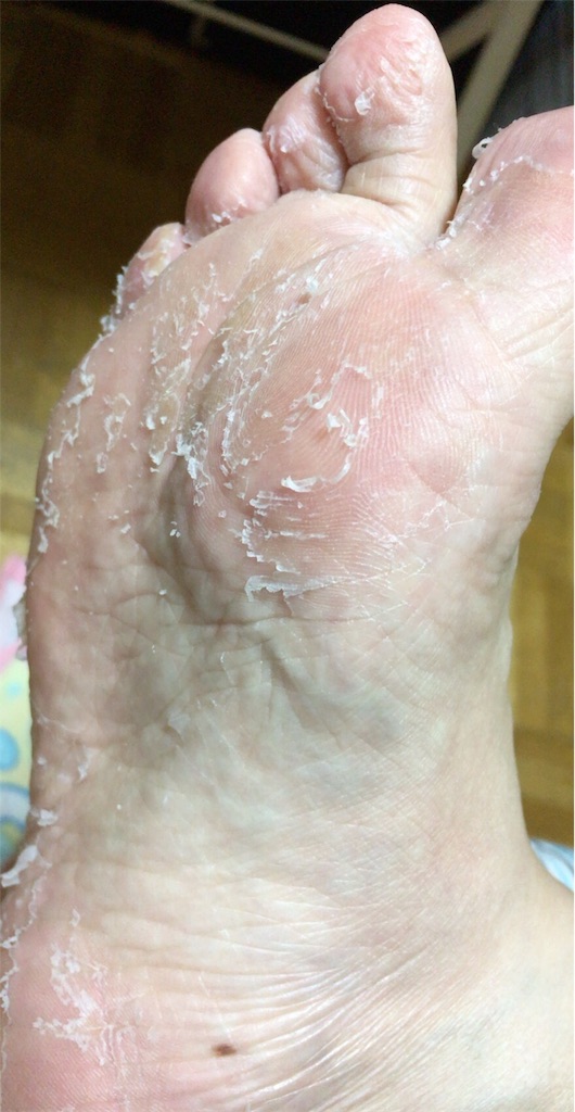 f:id:tsukunyan:20170508183738j:image