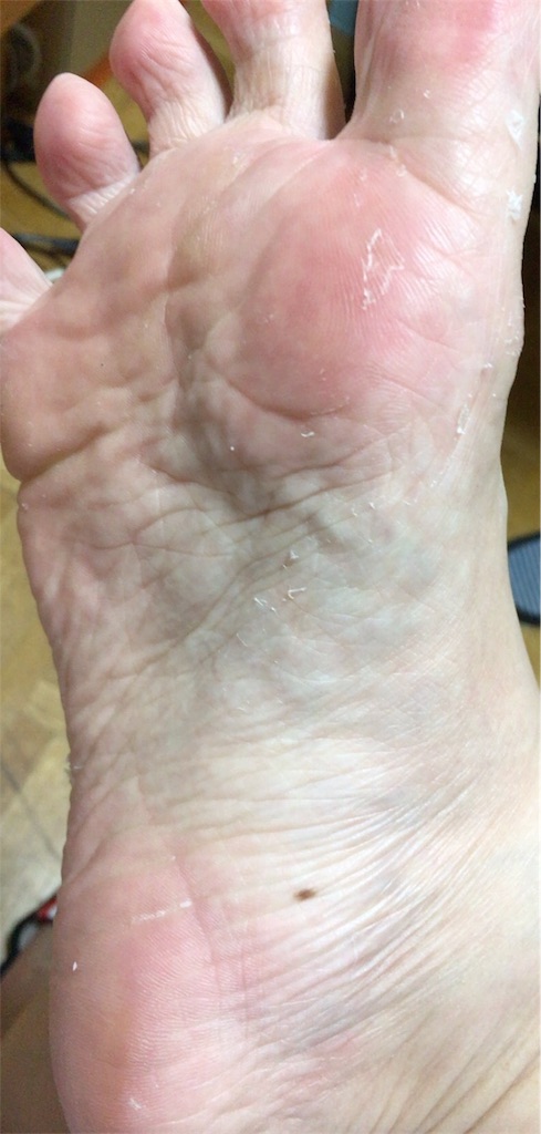 f:id:tsukunyan:20170508183759j:image