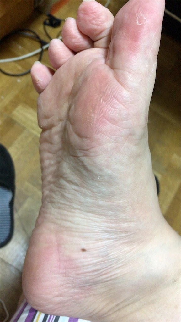 f:id:tsukunyan:20170508183809j:image