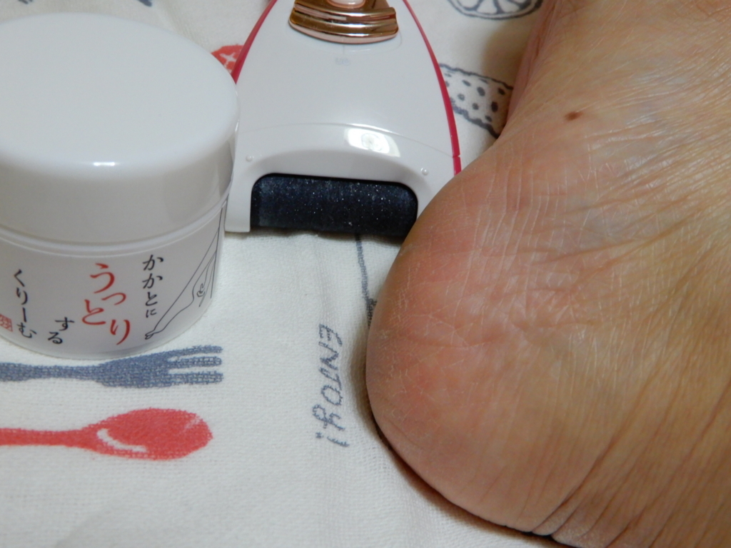 f:id:tsukunyan:20171123231238j:plain