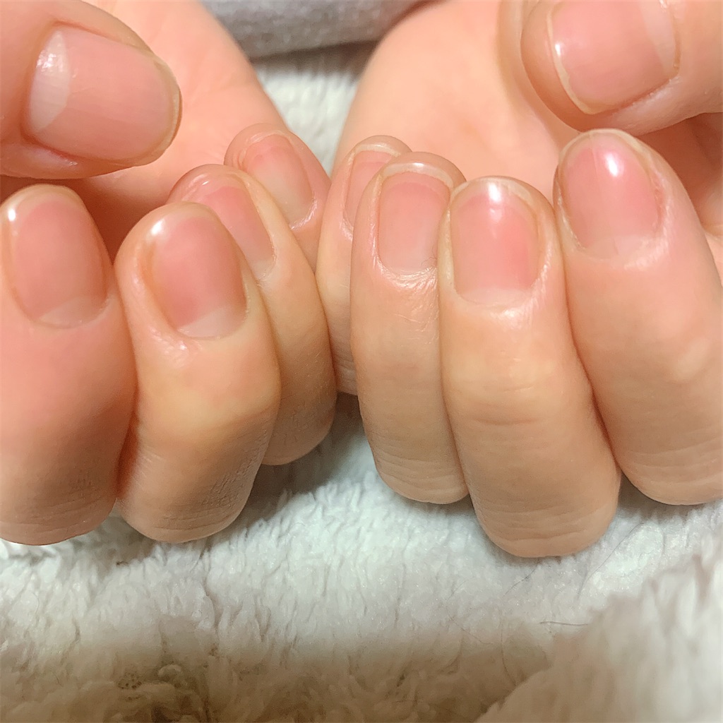 f:id:tsumecare_hitomi:20210104002811j:image