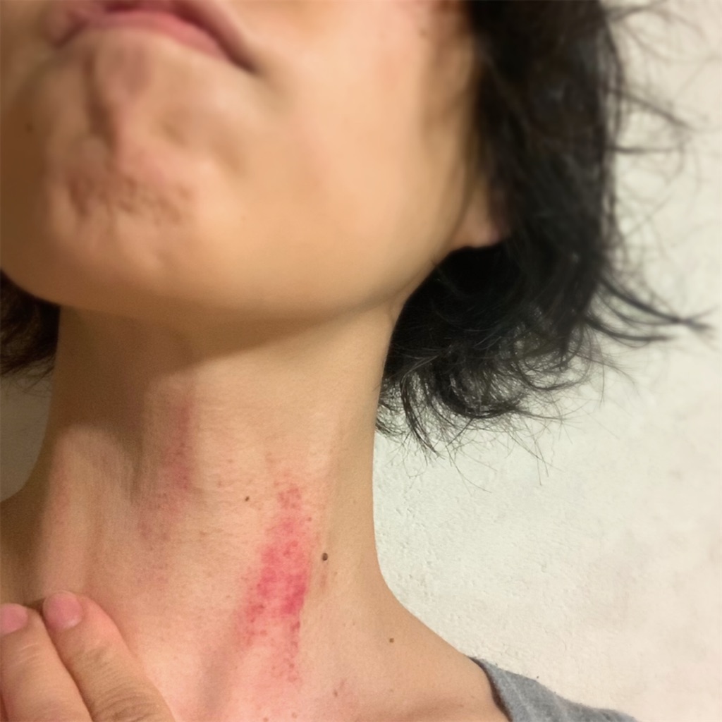 f:id:tsumecare_hitomi:20210821212137j:image