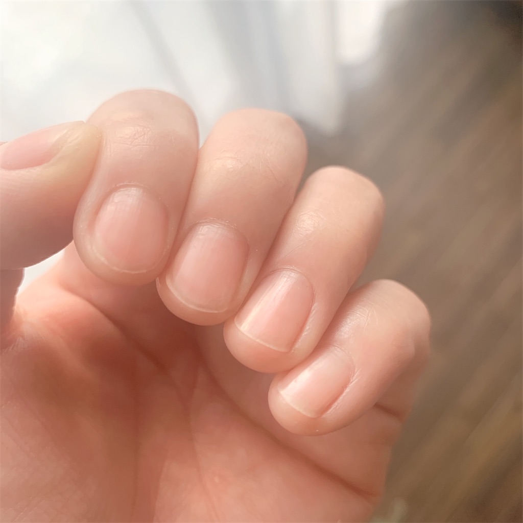 f:id:tsumecare_hitomi:20220104221321j:image f:id:tsumecare_hitomi:20220104221321j:image