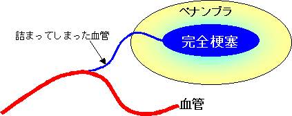 f:id:tsunepi:20140428100356g:plain