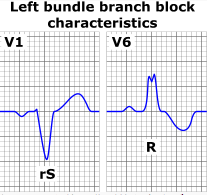 f:id:tsunepi:20140911204142p:plain