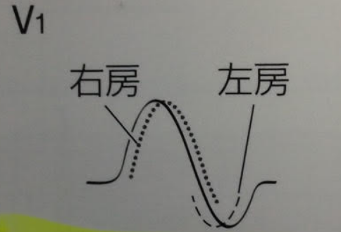 f:id:tsunepi:20141020175143p:plain f:id:tsunepi:20141020175143p:plain