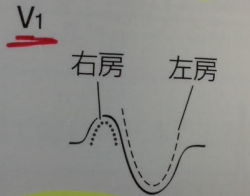 f:id:tsunepi:20141020175157p:plain f:id:tsunepi:20141020175157p:plain