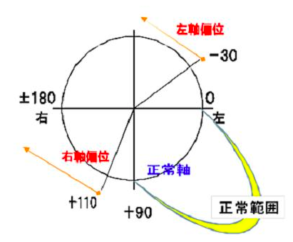 f:id:tsunepi:20150306134959p:plain f:id:tsunepi:20150306134959p:plain